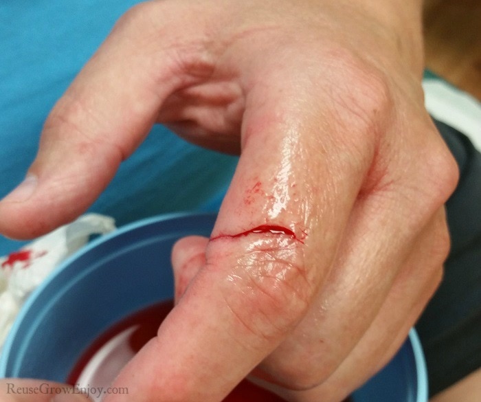 Hand with a cut on it